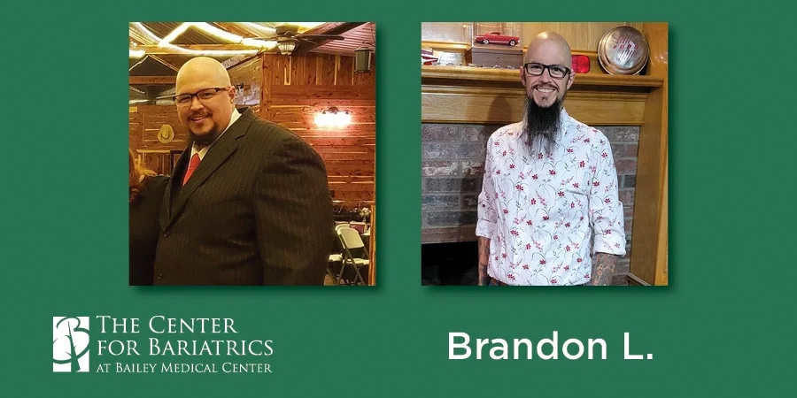 brandon before and after weight loss photos