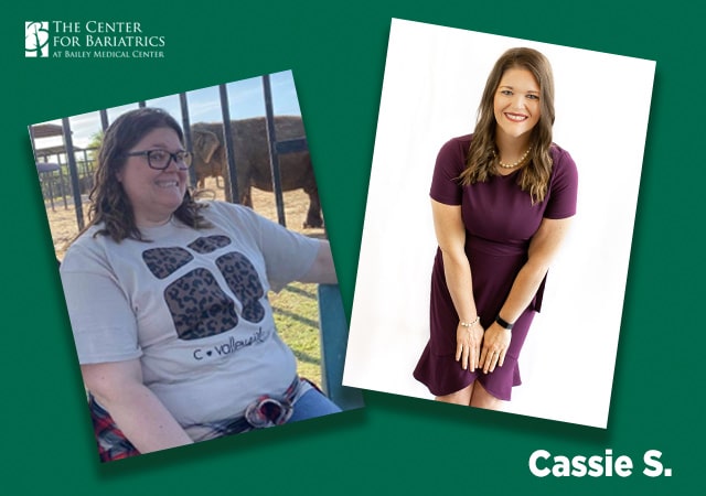 cassie weight loss before and after photos