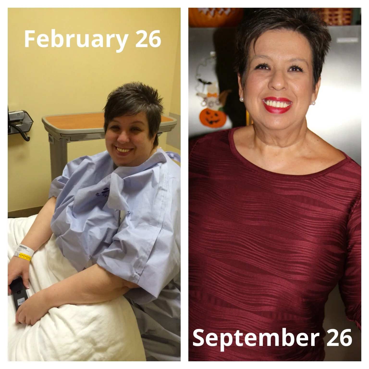 Denise's weight loss photos