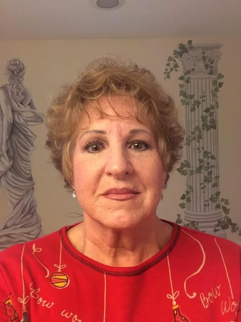 Weight loss patient Judy