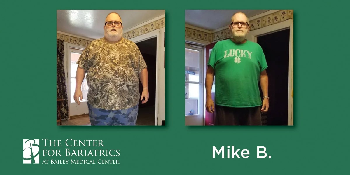 mike before and after weight loss photos
