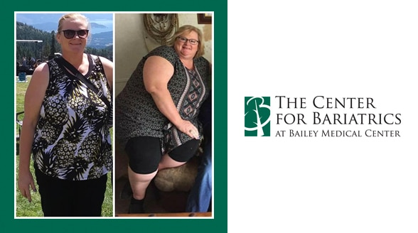 pamela walters before and after weight loss photos