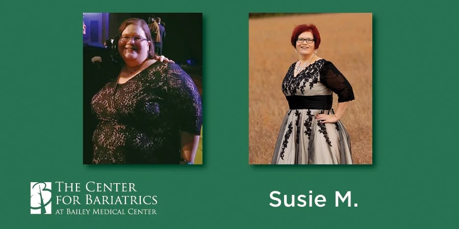 susie before and after weight loss photos
