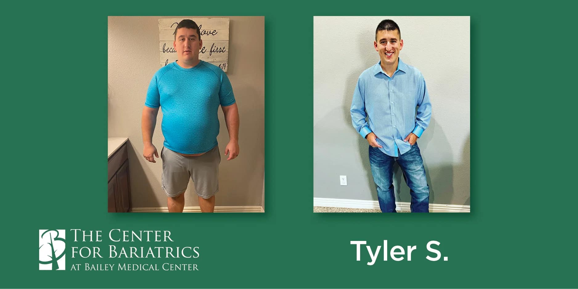 tyler before and after weight loss photos